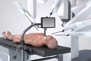 Robotic Surgery